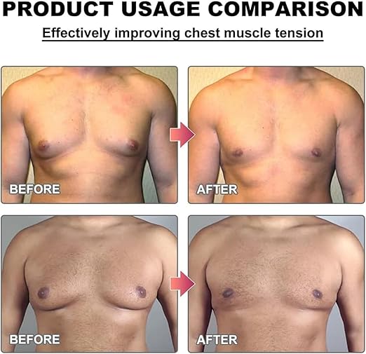 Men Therm - Bee Venom Gynecomastia Heating Oil (Original)