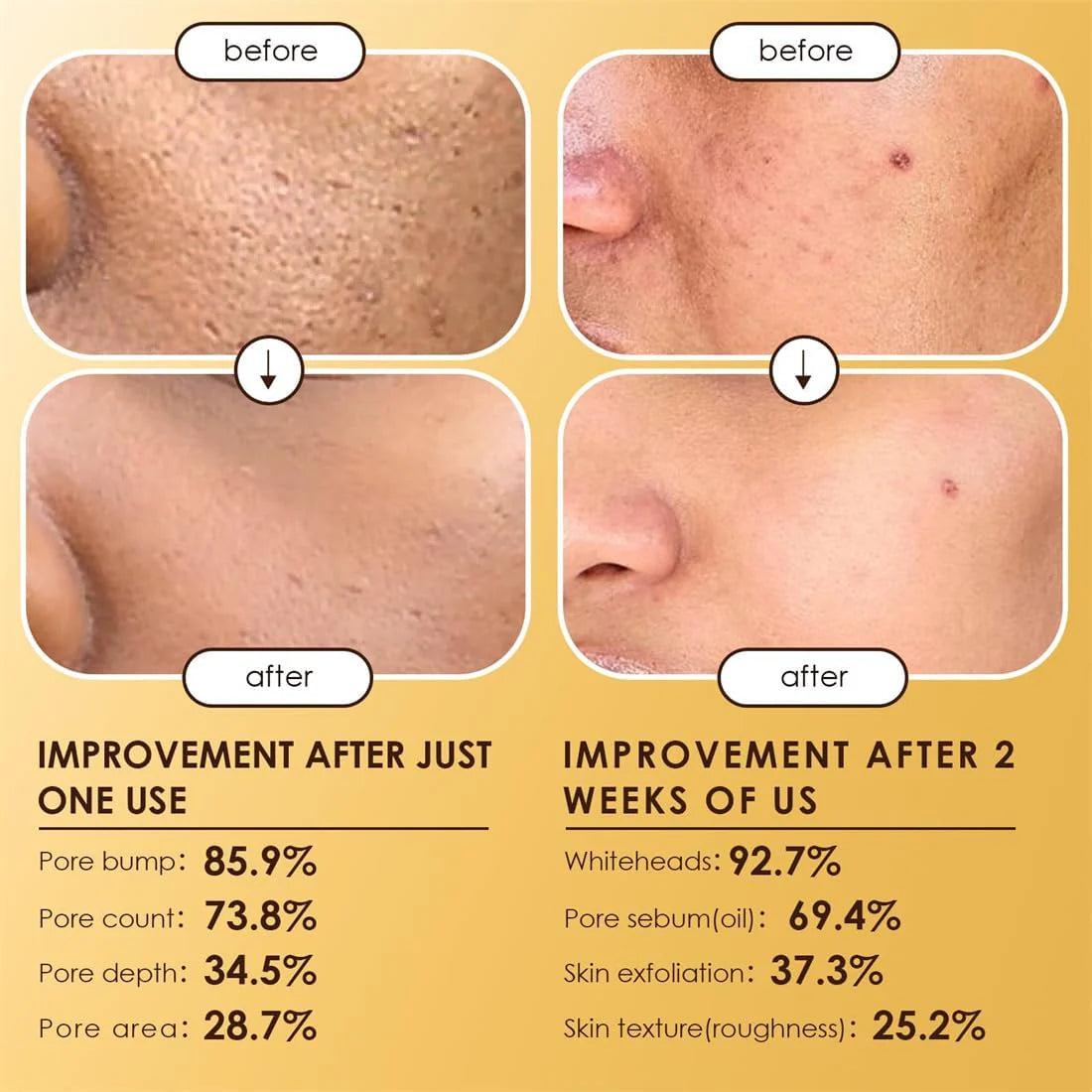 Moolinse Peel Shot P5 Exfoliant Ampoule (Pack of 2)